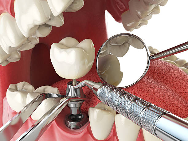 Best Dental Abscess Treatment in Andrews, SC